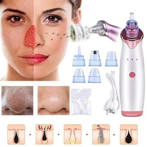 "GlowSkinβ’ Portable Blackhead Remover"