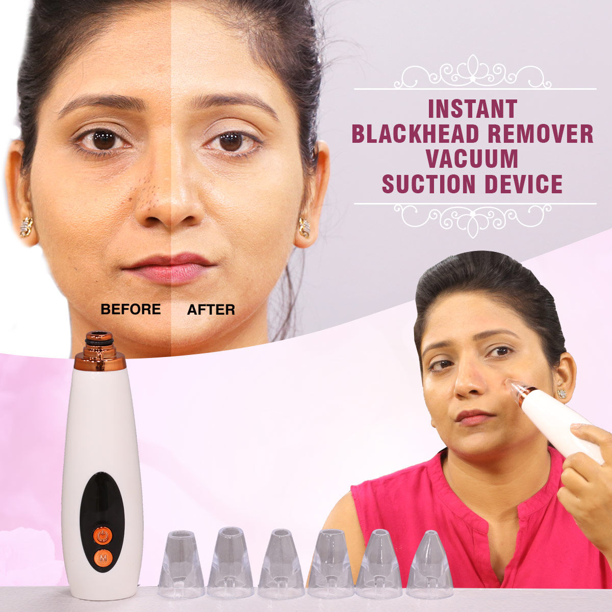 "GlowSkinβ’ Portable Blackhead Remover"