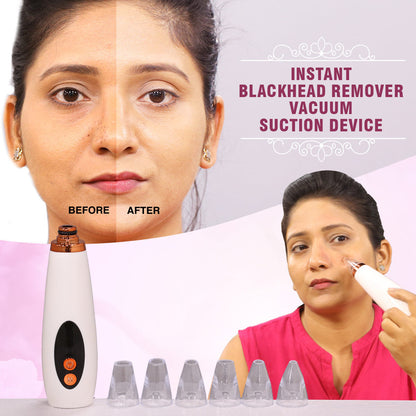 "GlowSkin™ Portable Blackhead Remover"
